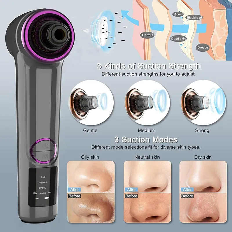 Aparat de Indepartat Puncte Negre, cu Vacuum SINZO®, 5 tipuri de cap de aspiratie, 3 programe de aspirare, 3 moduri de reglare a vitezei, incarcare USB