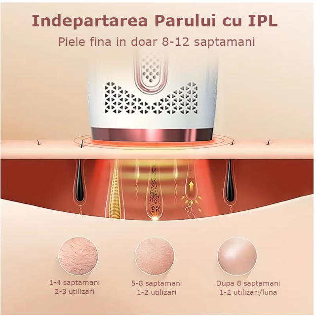 Epilator IPL, epilare definitiva fara durere, 999.999 impulsuri, 5 trepte de intensitate