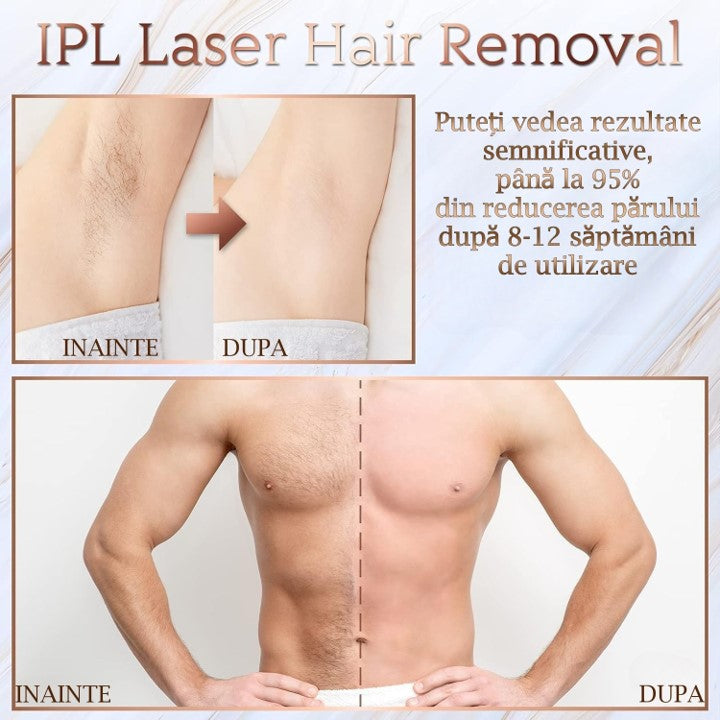 Epilator IPL, epilare definitiva fara durere, 999.999 impulsuri, 5 trepte de intensitate