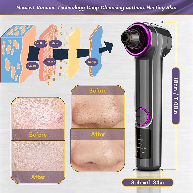 Aparat de Indepartat Puncte Negre, cu Vacuum SINZO®, 5 tipuri de cap de aspiratie, 3 programe de aspirare, 3 moduri de reglare a vitezei, incarcare USB