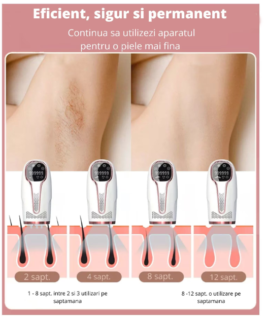 Epilator IPL, epilare definitiva fara durere, 999.999 impulsuri, 5 trepte de intensitate